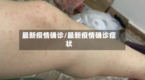 最新疫情确诊/最新疫情确诊症状