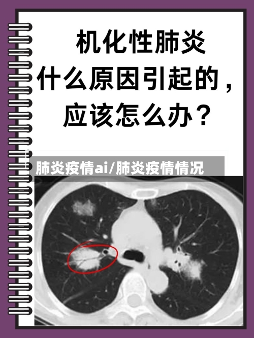 肺炎疫情ai/肺炎疫情情况-第3张图片