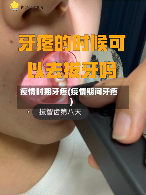 疫情时期牙疼(疫情期间牙疼)-第2张图片