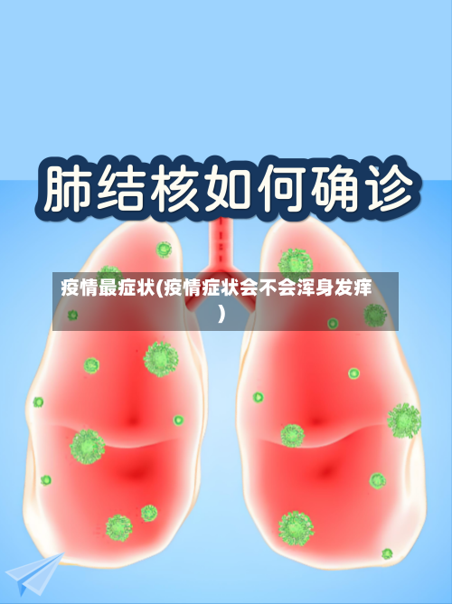 疫情最症状(疫情症状会不会浑身发痒)